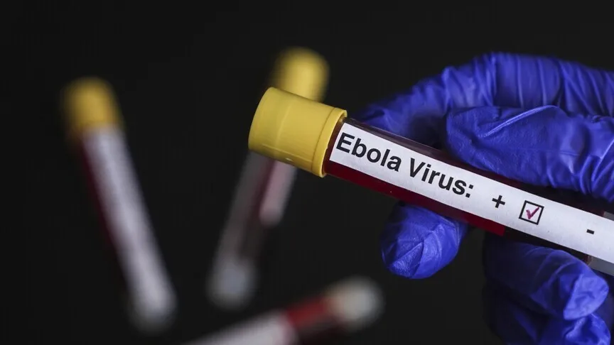 DSÖ: "KDC'de Ebola salgınında durum ciddiyetini sürdürüyor"