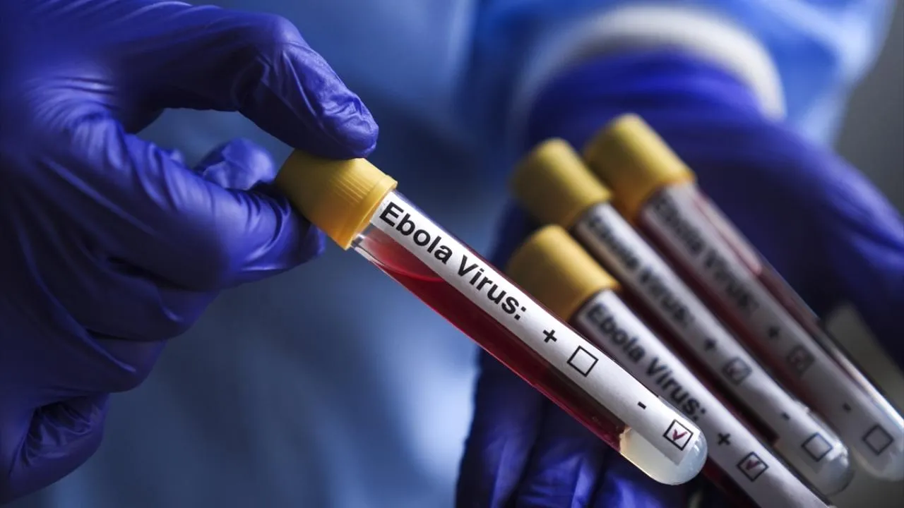 Kongo Demokratik Cumhuriyeti'ndeki Ebola salgınının gerçek boyutlarının henüz belirlenemediği bildirildi